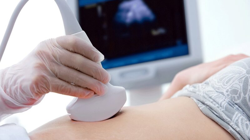 Alcântaro Filho propõe ouvir coração do bebê antes de tomar decisão sobre aborto